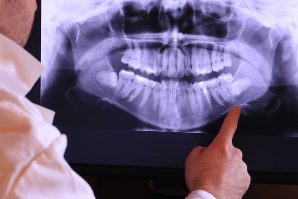 Best Urgent Care for Lost Fillings or Crowns in Mangum, OK