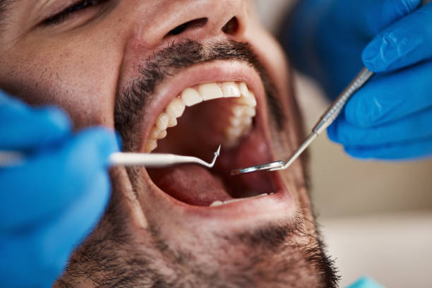 Best After-Hours Dental Trauma Care in Mangum, OK