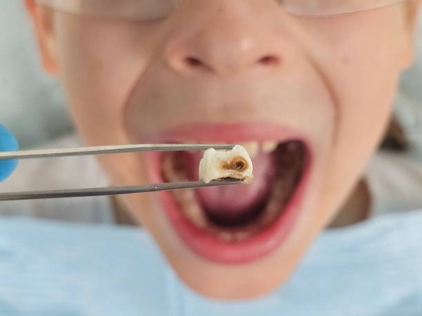 Best Emergency Gum Treatment in Mangum, OK