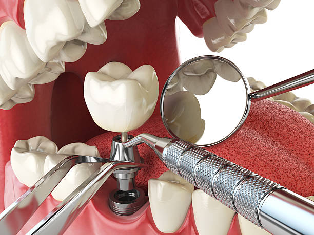 Best Emergency Tooth Extraction in Mangum, OK